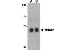 Western Blotting (WB) image for anti-Mex-3 Homolog C (C. Elegans) (MEX3C) (C-Term) antibody (ABIN1030621) (MEX3C antibody  (C-Term))