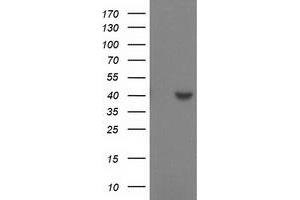 Western Blotting (WB) image for anti-Sulfotransferase Family, Cytosolic, 1C, Member 2 (SULT1C2) antibody (ABIN1501231) (SULT1C2 antibody)