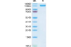 VLDLR Protein (AA 28-797) (His tag)
