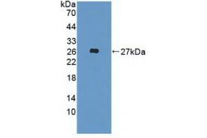 Detection of Recombinant FGF19, Human using Polyclonal Antibody to Fibroblast Growth Factor 19 (FGF19) (FGF19 antibody  (AA 4-216))