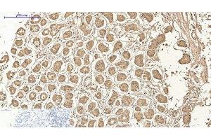 Immunohistochemistry of paraffin-embedded Human stomach tissue using AMACR Monoclonal Antibody at dilution of 1:200. (AMACR antibody)