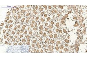 Immunohistochemistry of paraffin-embedded Human stomach tissue using AMACR Monoclonal Antibody at dilution of 1:200.