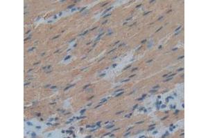 Detection of ACTC1 in Human Rectum Tissue using Anti-Actin Alpha 1, Cardiac Muscle (ACTC1) Polyclonal Antibody