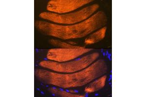Immunofluorescence analysis of mouse bone marrow using Troponin I2 (Troponin I2 (TNNI2)) Rabbit mAb (ABIN1679777, ABIN7101727, ABIN7101728 and ABIN7101729) at dilution of 1:100 (40x lens). (TNNI2 antibody)