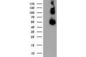Western Blotting (WB) image for anti-Calcium Binding and Coiled-Coil Domain 2 (CALCOCO2) antibody (ABIN1497077)