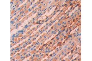 Used in DAB staining on fromalin fixed paraffin- embedded stomach tissue (CHN2 antibody  (AA 101-280))