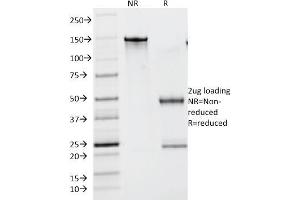 SDS-PAGE Analysis Purified Lambda Light Chain Monoclonal Antibody (N10/2). (IgL antibody)