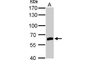 WB Image GAD67 antibody detects GAD67 protein by western blot analysis. (GAD antibody  (N-Term))