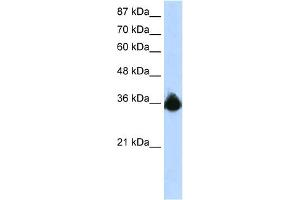 WB Suggested Anti-PTBP2 Antibody Titration:  1. (PTBP2 antibody  (N-Term))
