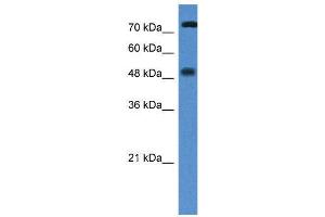 WB Suggested Anti-VDR AntibodyTitration: 1. (Vitamin D Receptor antibody  (N-Term))