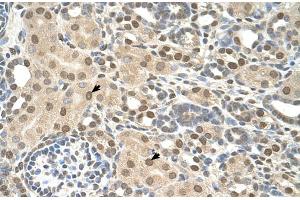 Rabbit Anti-TMEM30A Antibody  Paraffin Embedded Tissue: Human Kidney Cellular Data: Epithelial cells of renal tubule Antibody Concentration: 4. (TMEM30A antibody  (Middle Region))