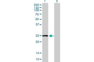 Western Blot analysis of ARL11 expression in transfected 293T cell line by ARL11 MaxPab polyclonal antibody. (ARL11 antibody  (AA 1-196))