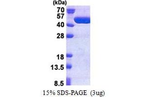 SDS-PAGE (SDS) image for TBC1 Domain Family, Member 13 (TBC1D13) (AA 1-400) protein (His tag) (ABIN5853203) (TBC1D13 Protein (AA 1-400) (His tag))