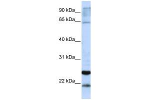 WB Suggested Anti-GSTA4 Antibody Titration:  0.