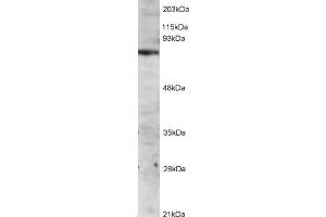 ABIN184605 staining (2µg/ml) of Jurkat lysate (RIPA buffer, 1. (ITK antibody  (C-Term))