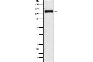 Western blot analysis of ANPRB expression in Human fetal kidney lysate.