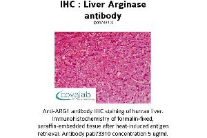 Image no. 1 for anti-Arginase, Liver (ARG1) (AA 1-145) antibody (ABIN1731930) (Liver Arginase antibody  (AA 1-145))