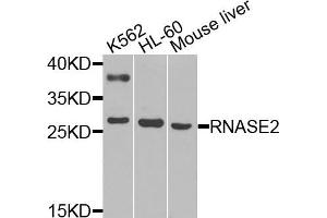Western blot analysis of extracts of various cells, using RNASE2 antibody.