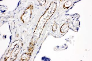 Anti-CD168 antibody, IHC(P) IHC(P): Human Placenta Tissue (HMMR antibody  (C-Term))