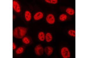 ABIN6268709 staining lovo cells by ICC/IF. (Lamin B antibody)