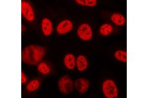ABIN6268709 staining lovo cells by ICC/IF.