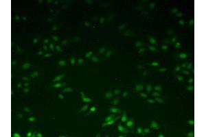 IHC-P analysis of Human HeLa cells, with FITC staining. (UBE2I antibody  (AA 33-158))