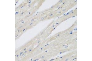 Immunohistochemistry of paraffin-embedded mouse heart using NAA50 antibody.