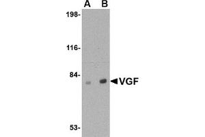Western blot analysis of VGF in human brain tissue lysate with this product at (A) 0.