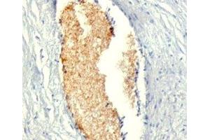 Formalin-fixed, paraffin-embedded human placenta stained with AMPD3 antibody (AMPD3/901) (AMPD3 antibody)