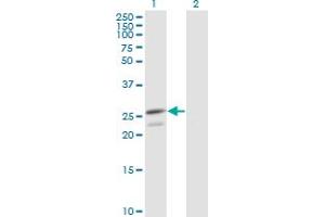 Western Blot analysis of PRDX3 expression in transfected 293T cell line by PRDX3 monoclonal antibody (M01), clone 1E3-B2. (Peroxiredoxin 3 antibody  (AA 1-256))