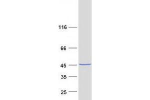 Western Blotting (WB) image for Cardiac Troponin T (cTnT) (Transcript Variant 3) protein (Myc-DYKDDDDK Tag) (ABIN2713174)