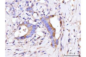 IHC analysis of GIGYF2 using anti-GIGYF2 antibody (ABIN7601679). (GIGYF2 antibody  (AA 413-1299))