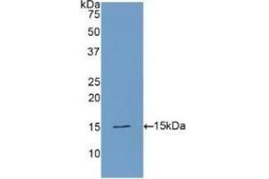 Detection of Recombinant PLAA, Human using Polyclonal Antibody to Phospholipase A2 Activating Protein (PLAP) (PLAA antibody  (AA 20-143))