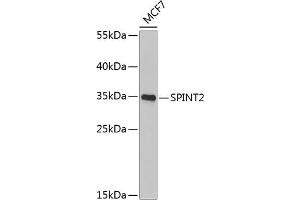 Western blot analysis of extracts of MCF-7 cells, using SPINT2 Antibody (ABIN6132838, ABIN6148361, ABIN6148362 and ABIN6222480) at 1:1000 dilution.