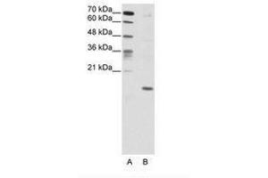 Image no. 1 for anti-Double Homeobox 5 (DUX5) (C-Term) antibody (ABIN203019) (DUX5 antibody  (C-Term))