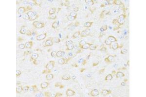 Immunohistochemistry of paraffin-embedded Mouse brain using DDX3Y Polyclonal Antibody at dilution of 1:100 (40x lens). (DDX3Y antibody)