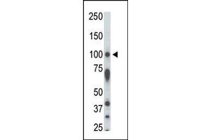 The anti-STK31 Pab (ABIN391358 and ABIN2841378) is used in Western blot to detect STK31 in rat testis tissue lysate. (STK31 antibody  (N-Term))