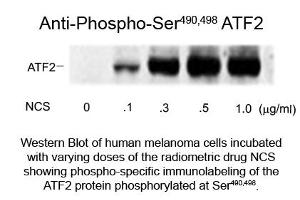Western Blot of Anti-ATF2 pS490/pS498 (Rabbit) Antibody - 609-401-D11 Western Blot of Rabbit Anti-ATF2 pS490/pS498 antibody.
