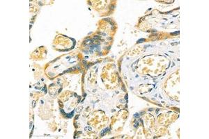 Immunohistochemistry of paraffin embedded human placenta using LOXL4 (ABIN7074541) at dilution of 1:400 (400x lens) (LOXL4 antibody)