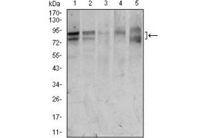 Western Blotting (WB) image for anti-Forkhead Box P1 (FOXP1) (AA 481-677) antibody (ABIN1845854) (FOXP1 antibody  (AA 481-677))