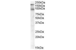 Image no. 2 for anti-CUB Domain Containing Protein 1 (CDCP1) (C-Term), (Isoform 1) antibody (ABIN374144) (CDCP1 antibody  (C-Term, Isoform 1))