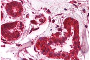 Immunohistochemistry (Paraffin-embedded Sections) (IHC (p)) image for anti-Forkhead Box O3 (FOXO3) (C-Term) antibody (ABIN6736383)