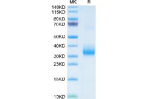 OLR1 Protein (AA 61-273) (His tag)