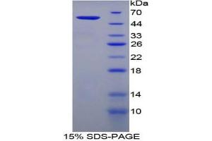 SDS-PAGE analysis of Mouse Filaggrin Protein. (Filaggrin Protein (FLG))