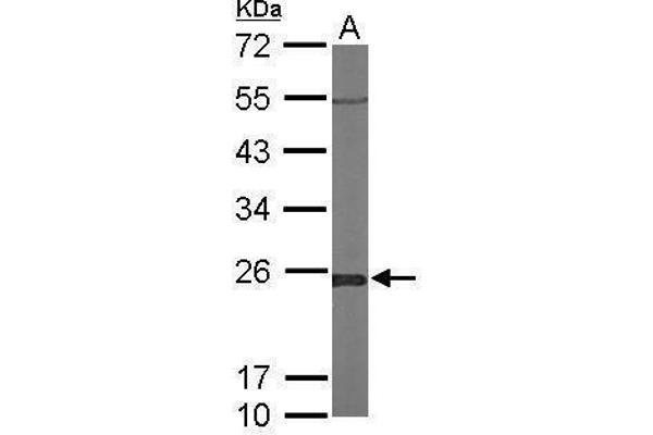 GLO1 antibody