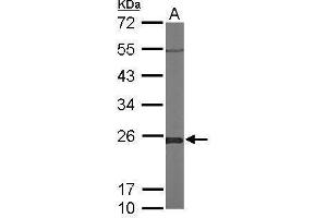 WB Image Sample (50 ug of whole cell lysate) A: Mouse brain 12% SDS PAGE antibody diluted at 1:1000 (GLO1 antibody)