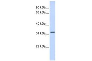 Image no. 1 for anti-Aprataxin (APTX) (AA 108-157) antibody (ABIN6742328) (Aprataxin antibody  (AA 108-157))
