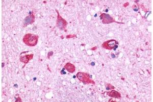 Anti-GPR150 antibody  ABIN1048734 IHC staining of human brain, neurons and glia. (GPR150 antibody  (N-Term))