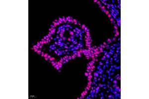 Immunofluorescence of paraffin embedded rat uterus using Skar (ABIN7074970) at dilution of 1:950 (400x lens) (p46 antibody)