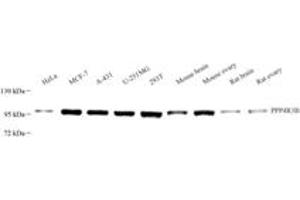 Western blot analysis of SMEK2 (ABIN7074520),at dilution of 1: 3000